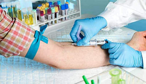 exames-de-sangue-melhor-convênio-médico